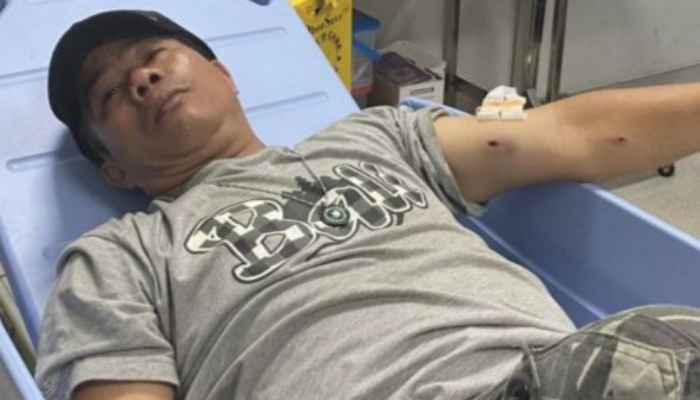 Pencurian Sepeda Motor Pakai Senpi Lukai 1 Orang