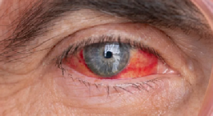 retina mata